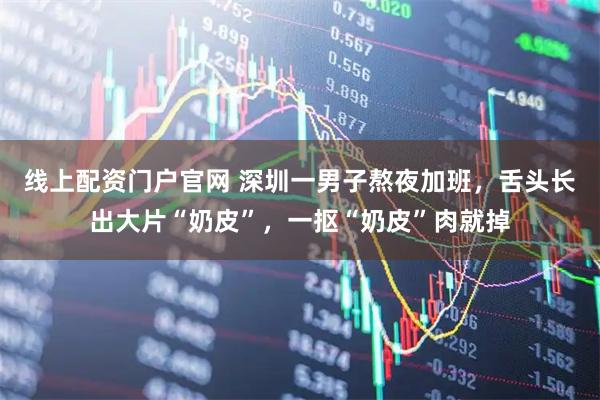 线上配资门户官网 深圳一男子熬夜加班，舌头长出大片“奶皮”，一抠“奶皮”肉就掉